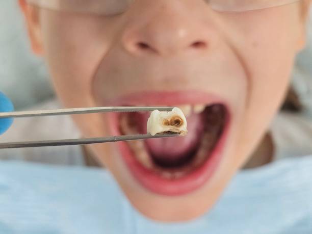 Best Tooth Pain Emergency Relief  in Nogales, AZ